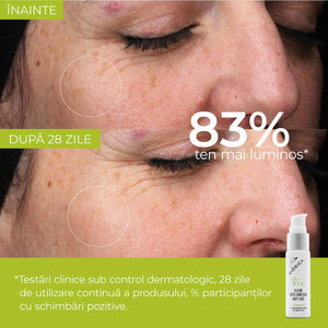 Ser „Elixir Vitis Vinifera Anti-Age”, Viorica Vie